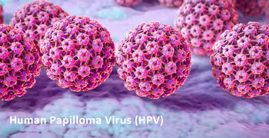 Human Papilloma Virus
